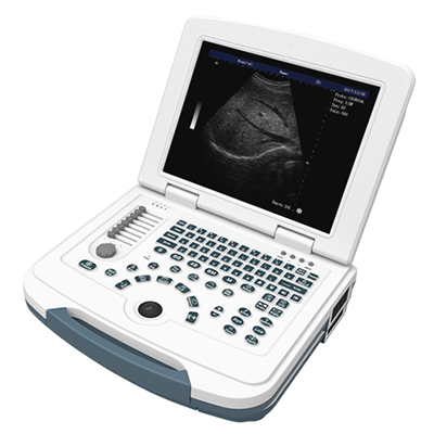 Laptop Full Digital Ultrasound Scanner