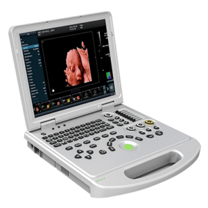 Ultrasound Scanner 5D Color Doppler K5