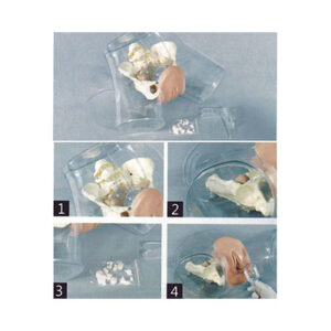 Transparent Curettage Model T32