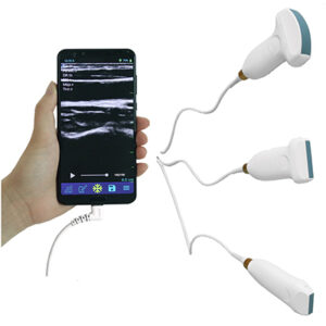 Wired Probe Type Ultrasound Scanner